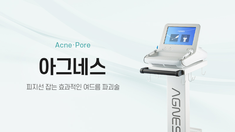 아그네스