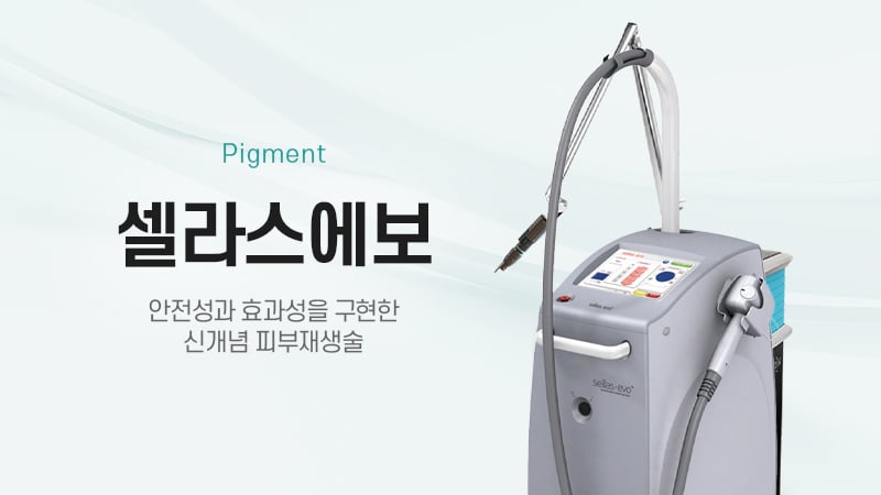 셀라스에보