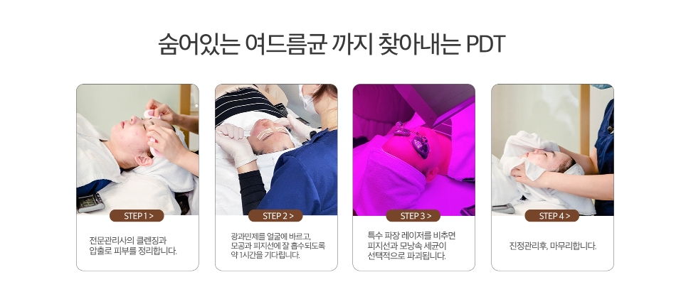 홍대 PDT 여드름치료 닥터에버스 홍대 PDT 여드름치료 닥터에버스