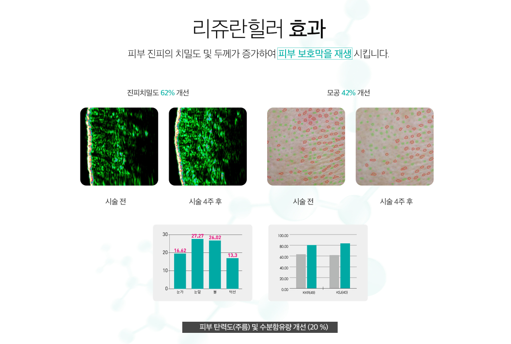 리쥬란힐러 홍대피부과 닥터에버스