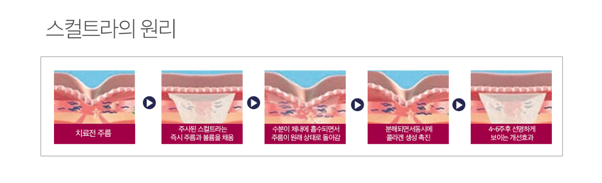 스컬트라 콜라겐부스터 닥터에버스 스컬트라 콜라겐부스터 닥터에버스
